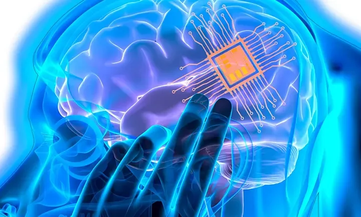 El implante cerebral chino, NEO, marca un cambio de era en la medicina y la sociedad